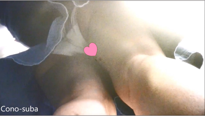 Cono-suba