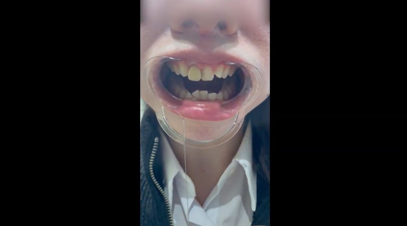 【再販】【完全素人・個人撮影】美女人妻を歯科検診余す所なく完全公開。