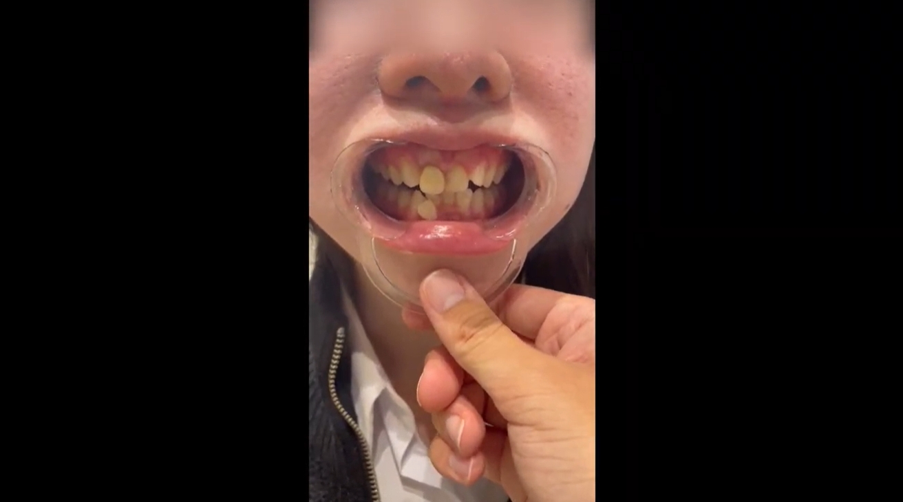 【再販】【完全素人・個人撮影】美女人妻を歯科検診余す所なく完全公開。