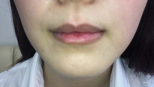 【再販】【リアル素人】白シャツOLの口内詳細観察 - 治療跡/舌表裏/のどちんこまで完全収録