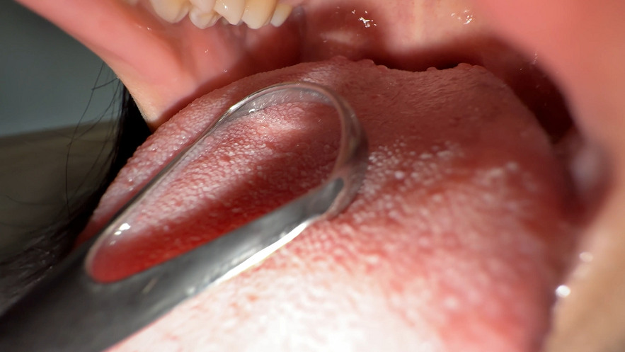 【再販】【個人撮影】大園明歩の舌ブラシで「汚舌苔」採取