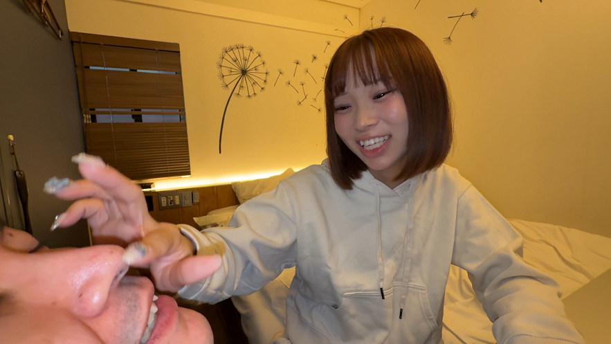 【再販】【個人撮影】渡来ふうの舌ブラシで「汚舌苔」採取