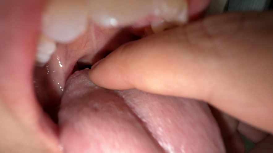 【再販】【個人撮影】浅桜エリの喉チンコ触り&口内観察