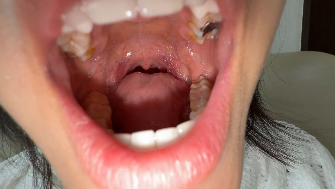 【再販】【個人撮影】乙葉らぶの喉チン触り&開口器アヘ顔Wピース