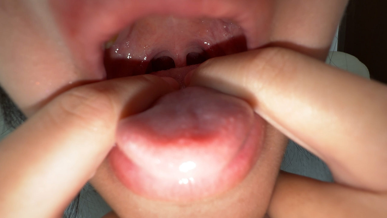 【再販】【個人撮影】乙葉らぶの喉チン触り&開口器アヘ顔Wピース