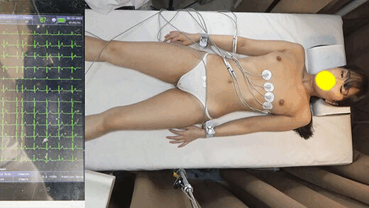 心電図検査室　あらがえない快感に脈が乱れる女性患者二名