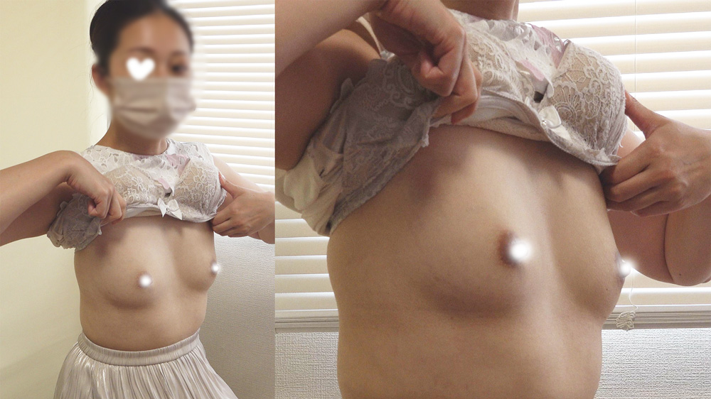 【一般外来】遂に肛門診察始めました…！美アナル美尻！綺麗な白いお尻に濃い目のアナルが目を引く人妻さん
